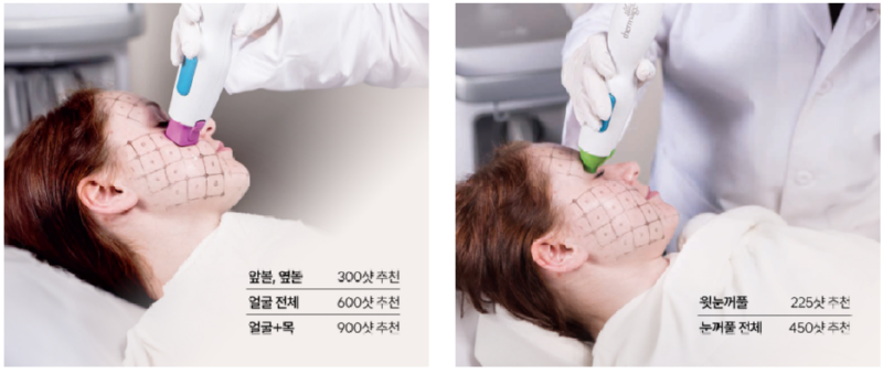 써마지 샷수